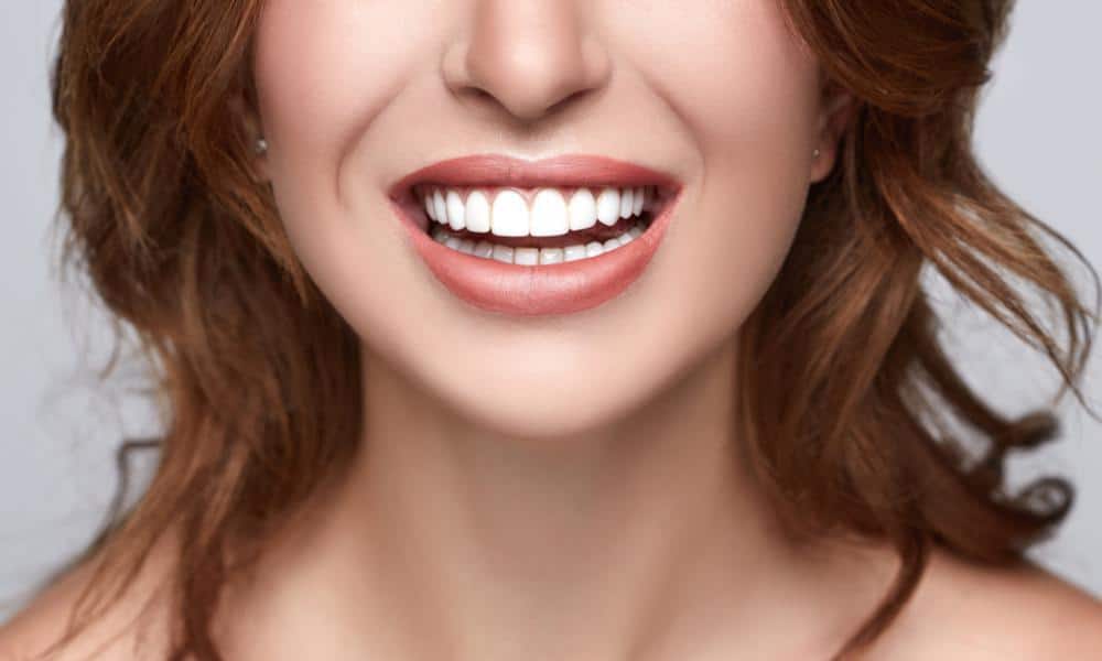 Featured image for “Make your TEETH PERFECT in 1 week with Dental Veneers”